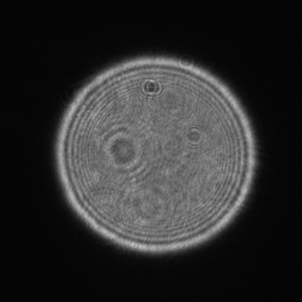 intrafocal.jpg